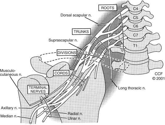 brachial plexus schematic diagram