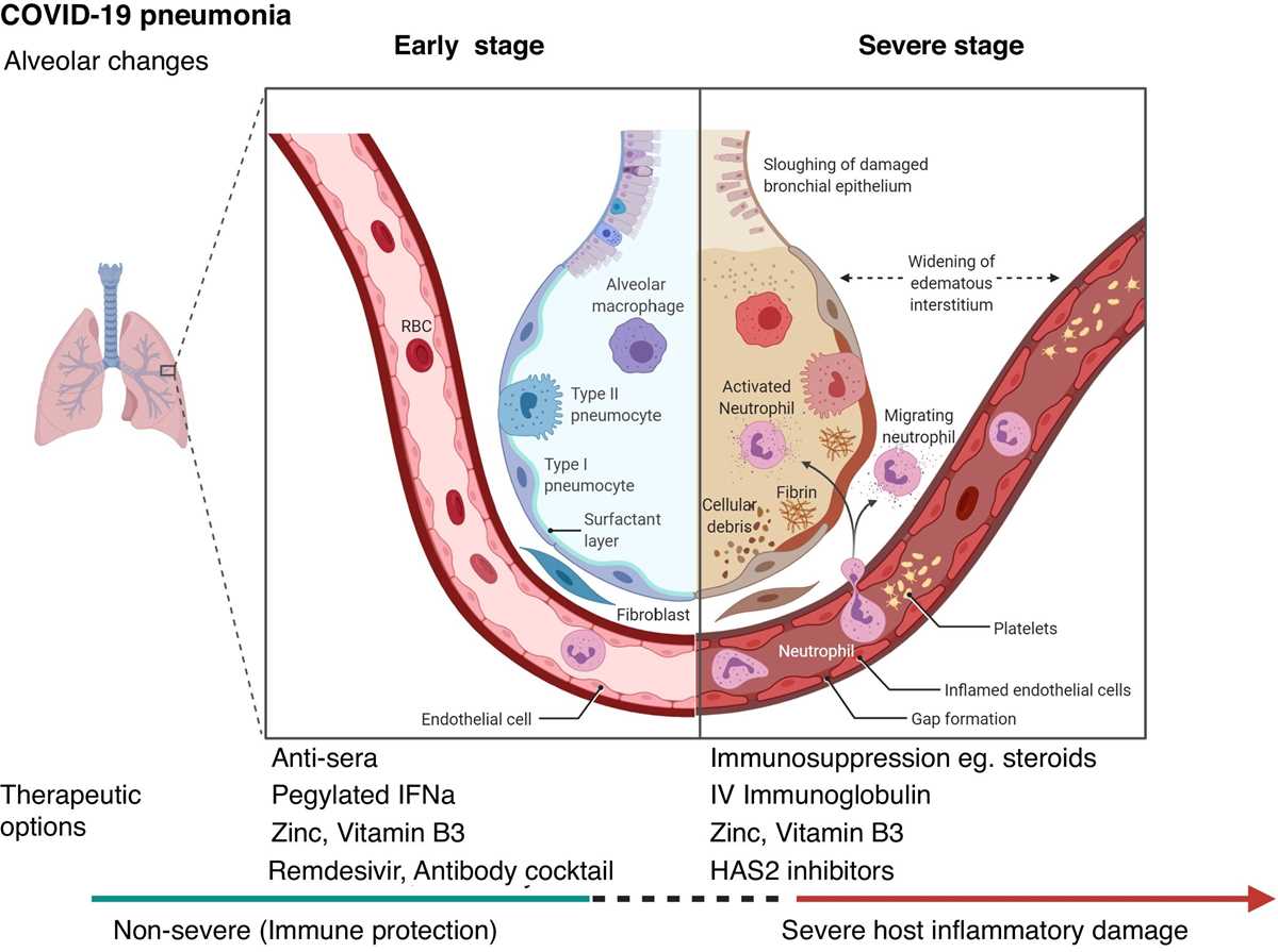 bronchopneumonia pathophysiology schematic diagram bronchopneumonia pathophysiology schematic diagram