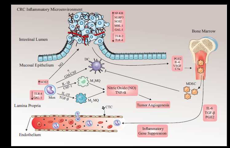 colorectal cancer schematic diagram colorectal cancer schematic diagram