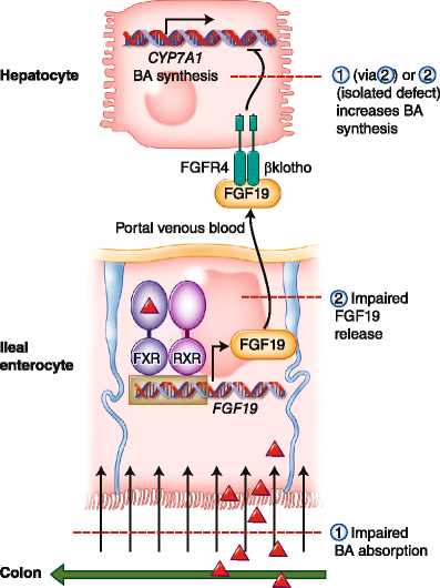 diarrhea schematic diagram
