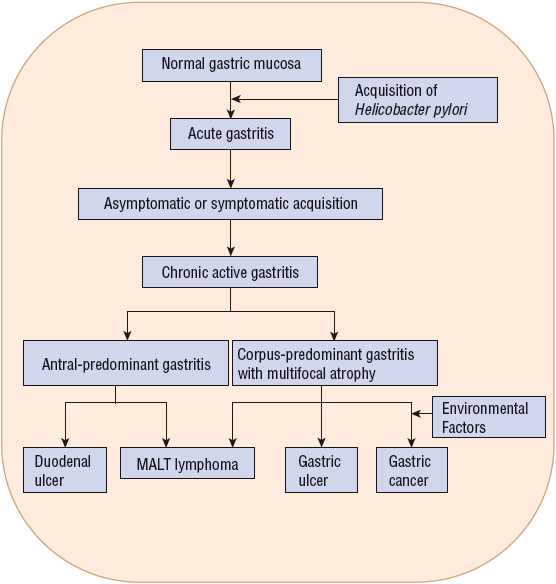 pathophysiology of peptic ulcer disease schematic diagram
