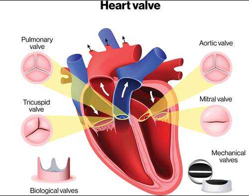 rheumatic heart disease pathophysiology schematic diagram rheumatic heart disease pathophysiology schematic diagram