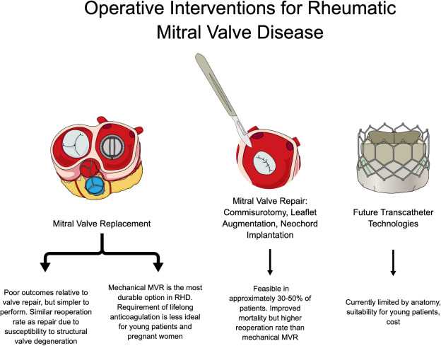 rheumatic heart disease pathophysiology schematic diagram rheumatic heart disease pathophysiology schematic diagram