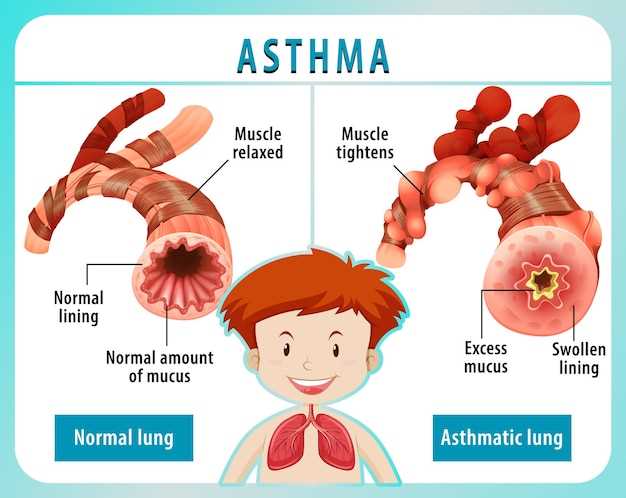 schematic diagram of pathophysiology of asthma schematic diagram of pathophysiology of asthma
