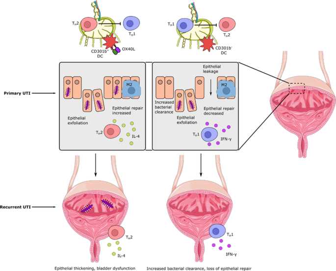 uti pathophysiology schematic diagram