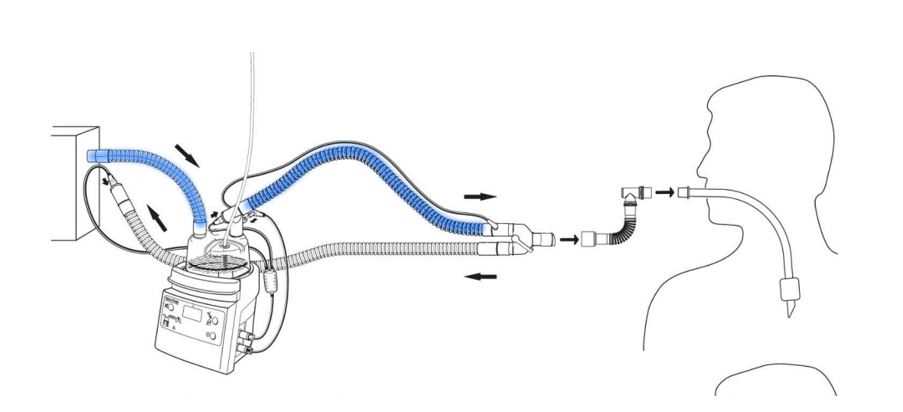 ventilator circuit diagram