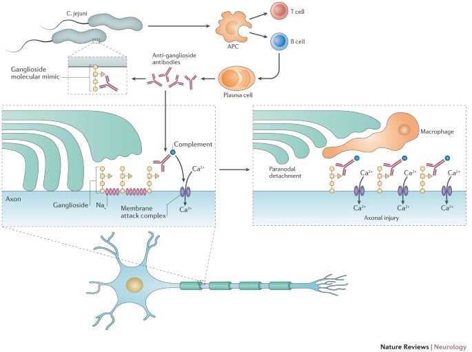 schematic diagram of pathophysiology of guillain barre syndrome schematic diagram of pathophysiology of guillain barre syndrome