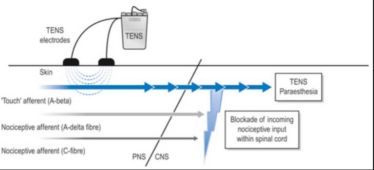 tens schematic diagram tens schematic diagram