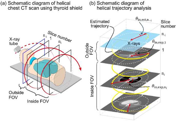 ct scan schematic diagram
