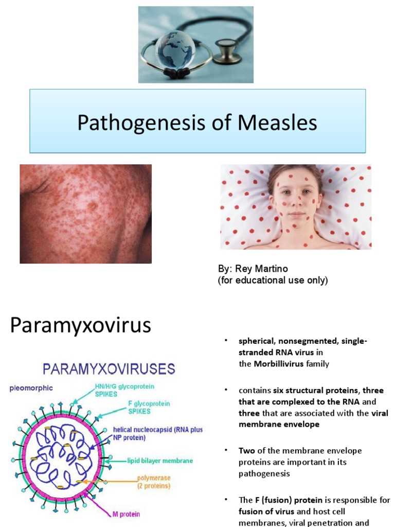 schematic diagram of pathophysiology of measles