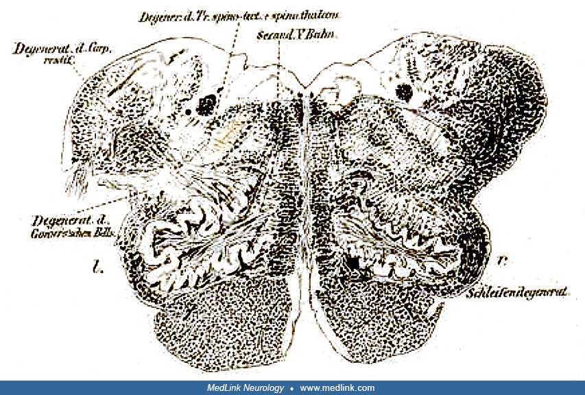 brain stem.schemata tract diagram brain stem.schemata tract diagram