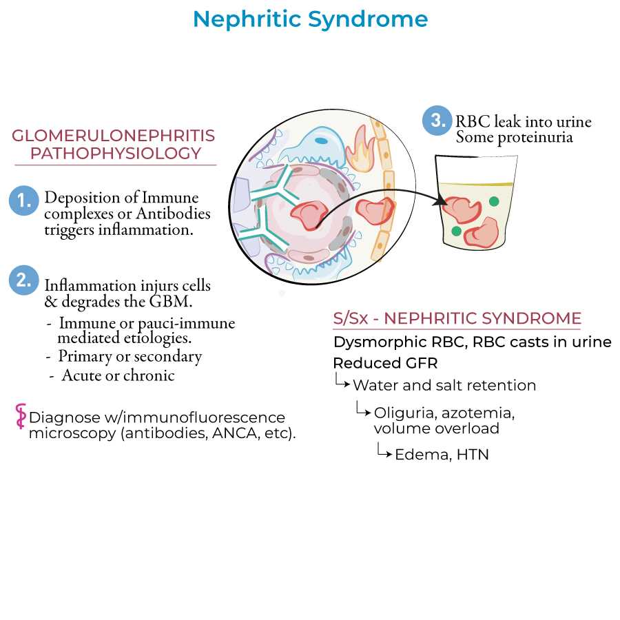 pathophysiology of glomerulonephritis schematic diagram