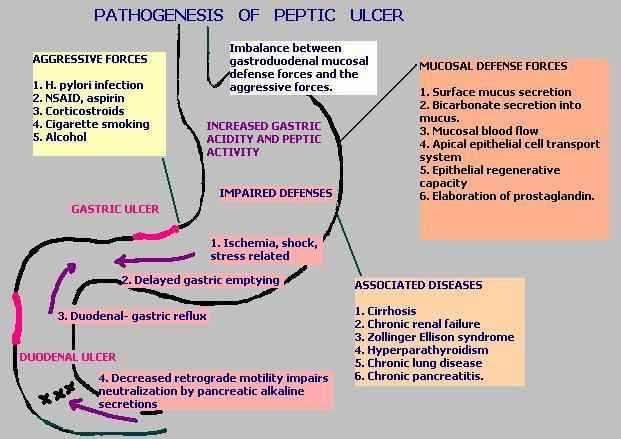 pathophysiology of peptic ulcer disease schematic diagram