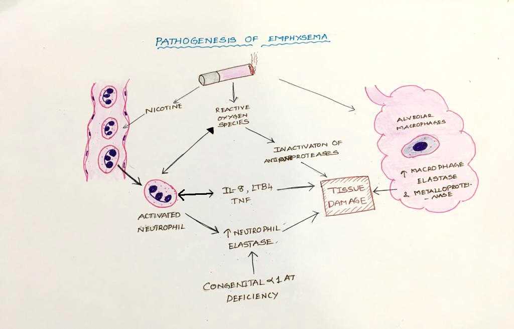 emphysema pathophysiology schematic diagram