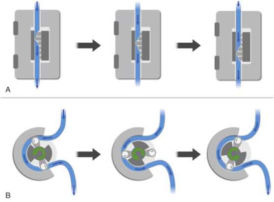 peristaltic pump schematic diagram