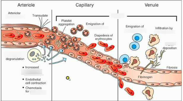 acute inflammation schematic diagram