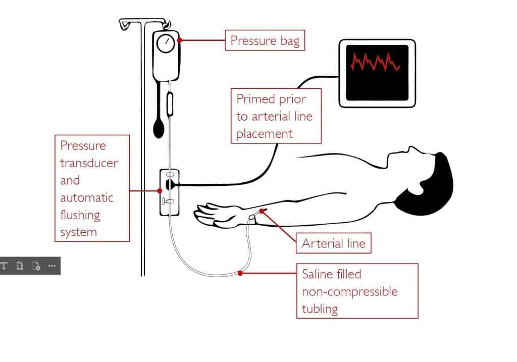 wiring schematic surgical prep diagrams