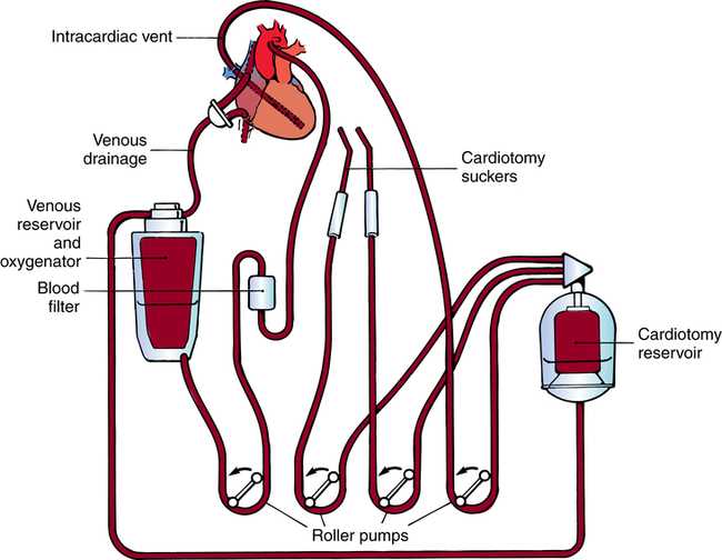 wiring schematic surgical prep diagrams